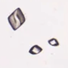 Quiz: urinalysis of a patient with frequent and recurrent kidney stones. What type of stone is she forming?