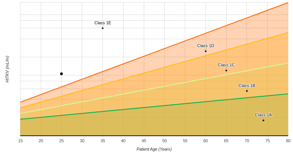 Classification of ADPKD graphically shown based on tkv and age