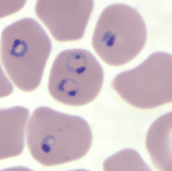 Quiz: plasmodium falciparum on the blood smear