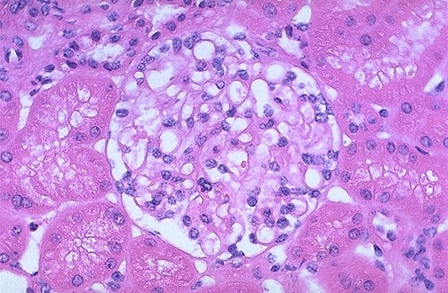 light microscopy normal glom quiz question